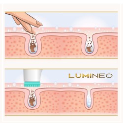 LUMINEO Professional Line Szczoteczka do twarzy Brush Pro turkusowa + Żel oczyszczajacy Lumineo do wszystkich typów cery 100 ml