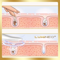LUMINEO Professional Line Szczoteczka do twarzy Sonic Thermo Brush + Żel Lumineo do skóry delikatnej i wrażliwej