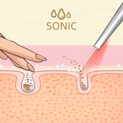 a LUMINEO Professional Line Peeling kawitacyjny LED 5w1 + Zestaw nawilżający Lumineo (Tonik, 2 x Serum, Krem)