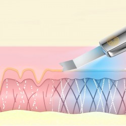 LUMINEO Professional Line Peeling kawitacyjny LED 5w1 + Tonik nawilżający do kawitacji Lumineo